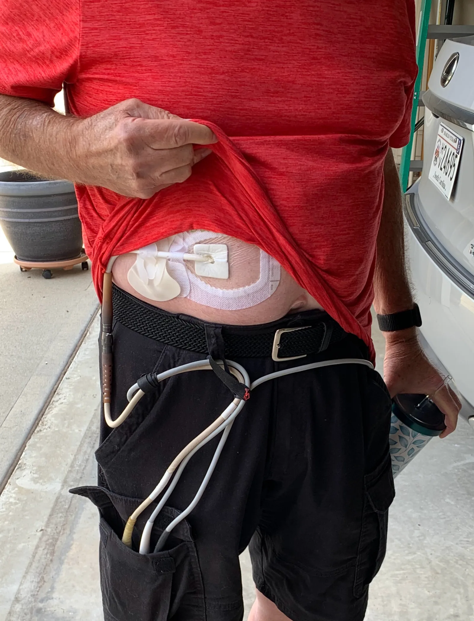 LVAD equipment worn under clothing